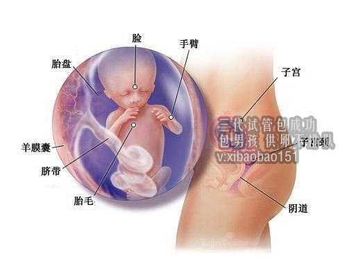 中国国内助孕机构,什么是宫内发育迟缓出现这种情况如何诊断