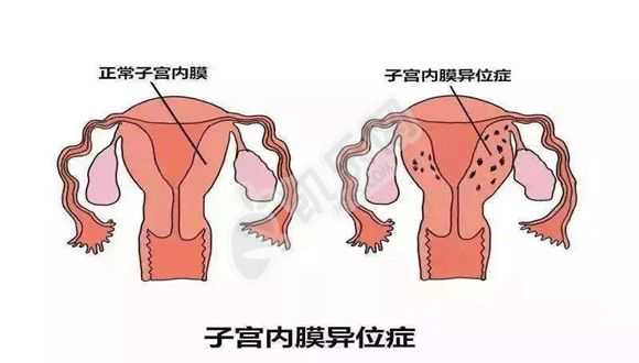 上海助孕医院经历,世界有五十六个性别定义